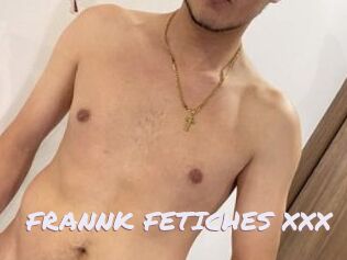 FRANNK_FETICHES_XXX