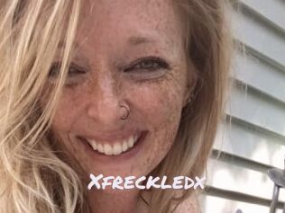 Xfreckledx